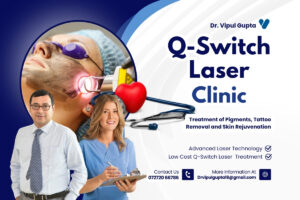 Q-Switch Laser