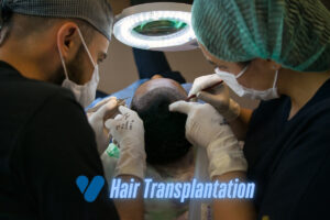 Hair Transplantation