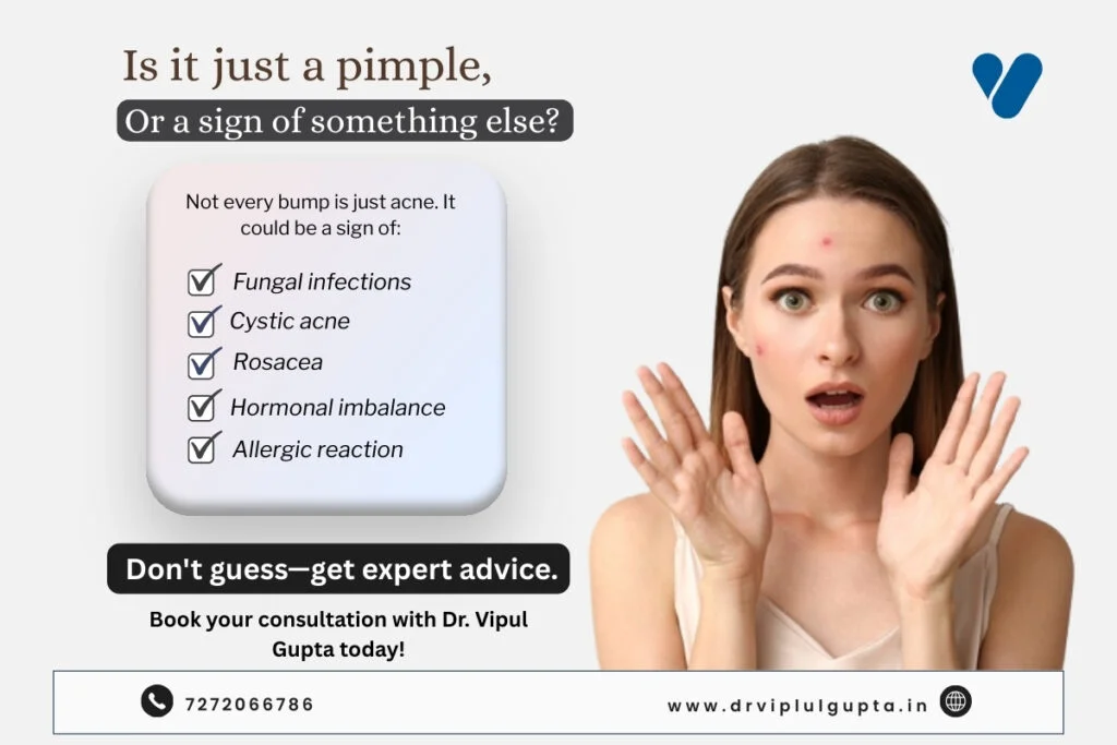 Pimple Removal